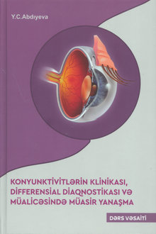 Konyunktivitlərin klinikası, differensial diaqnostikası və müalicəsində müasir yanaşma