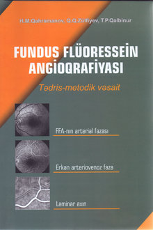 Fundus Flüoressein Angioqrafiyası