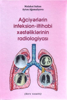 Ağciyərlərin infeksion-iltihabi xəstəliklərinin radiologiyası