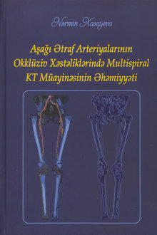 Aşağı ətraf arteriyalarının okklüziv xəstəliklərində multispiral KT müayinəsinin əhəmiyyəti