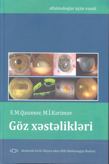 Göz xəstəlikləri