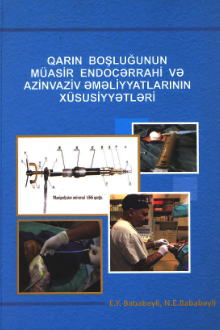 Qarın boşluğunun endocərrahi və azinvaziv əməliyyatlarının aktual xüsusiyyətləri